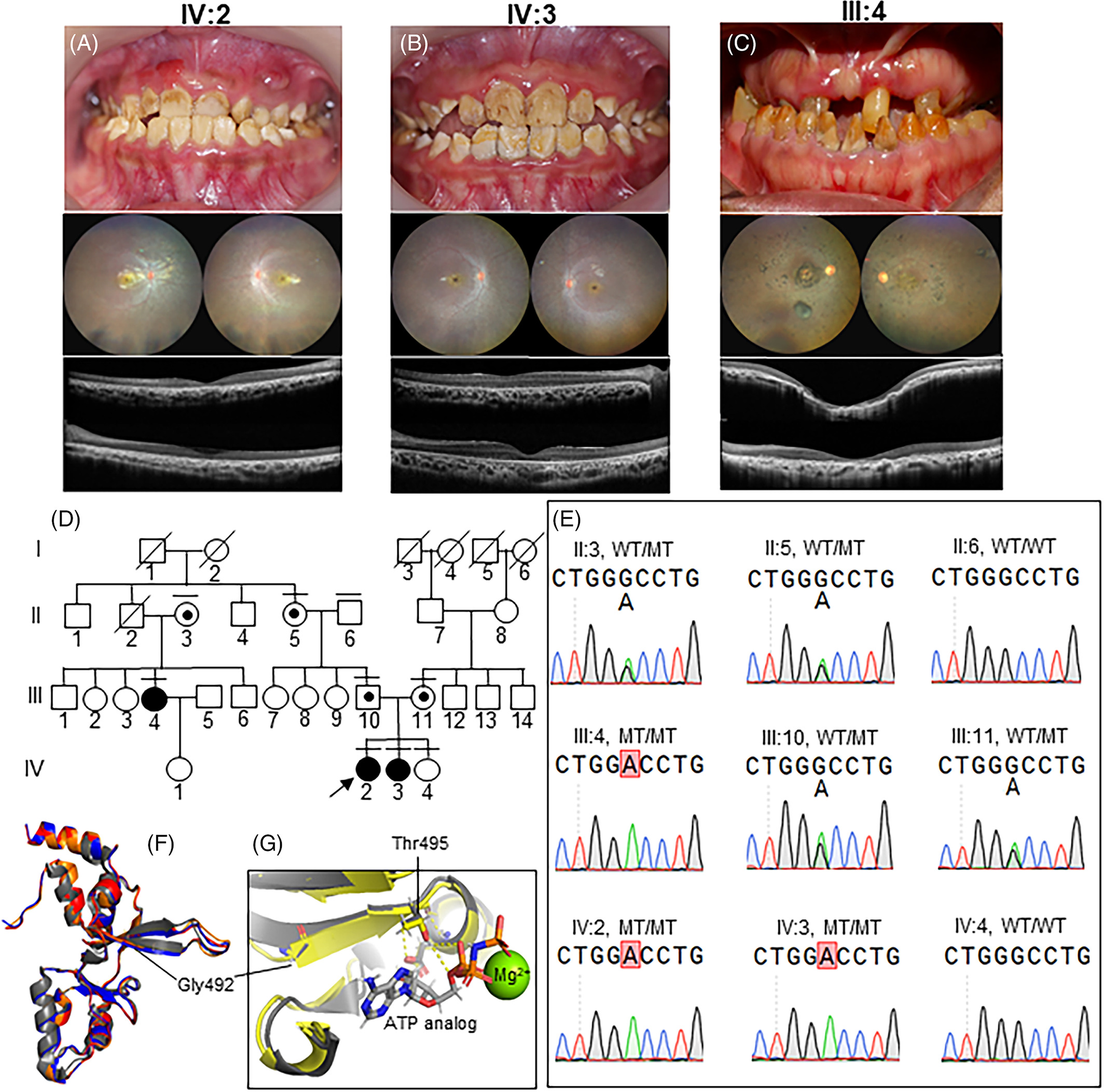 Center of Excellence in Genomics and Precision Dentistry